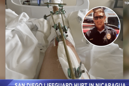 San Diego Lifeguard Todd Rice in hospital. Photo: Fox 5 News